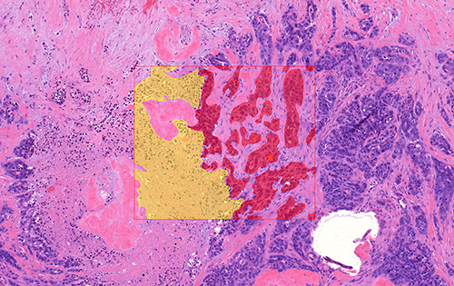 Screenshot of HistomicsTK showing cells
